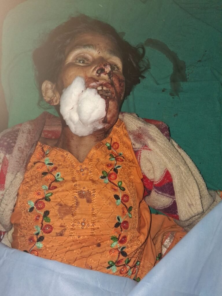 rayaal